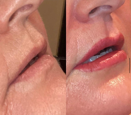 Lip Blushing Ashland KY - Before & After Treatment