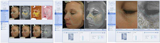 Skin Analysis Ashland KY