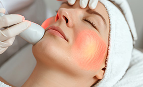 IPL Fotofacial Laser Ashland KY