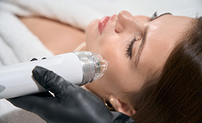 MicroNeedling with Radio Frequency Ashland KY