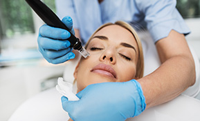 PRP MicroNeedling Facial Ashland KY